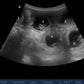 Ultrasounds