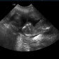 Ultrasounds