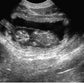 Ultrasounds